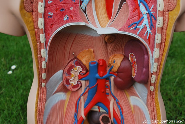 Cáncer renal, cómo afecta a los mexicanos