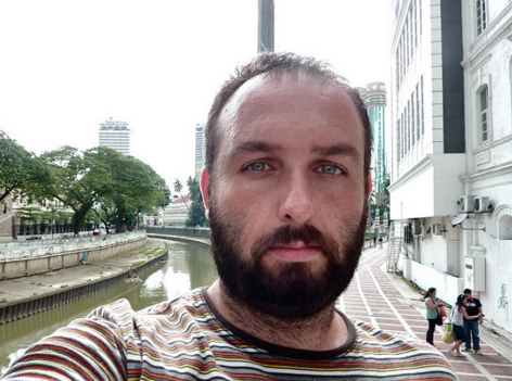 ¿Quién es tu mejor aliado contra la alopecia?